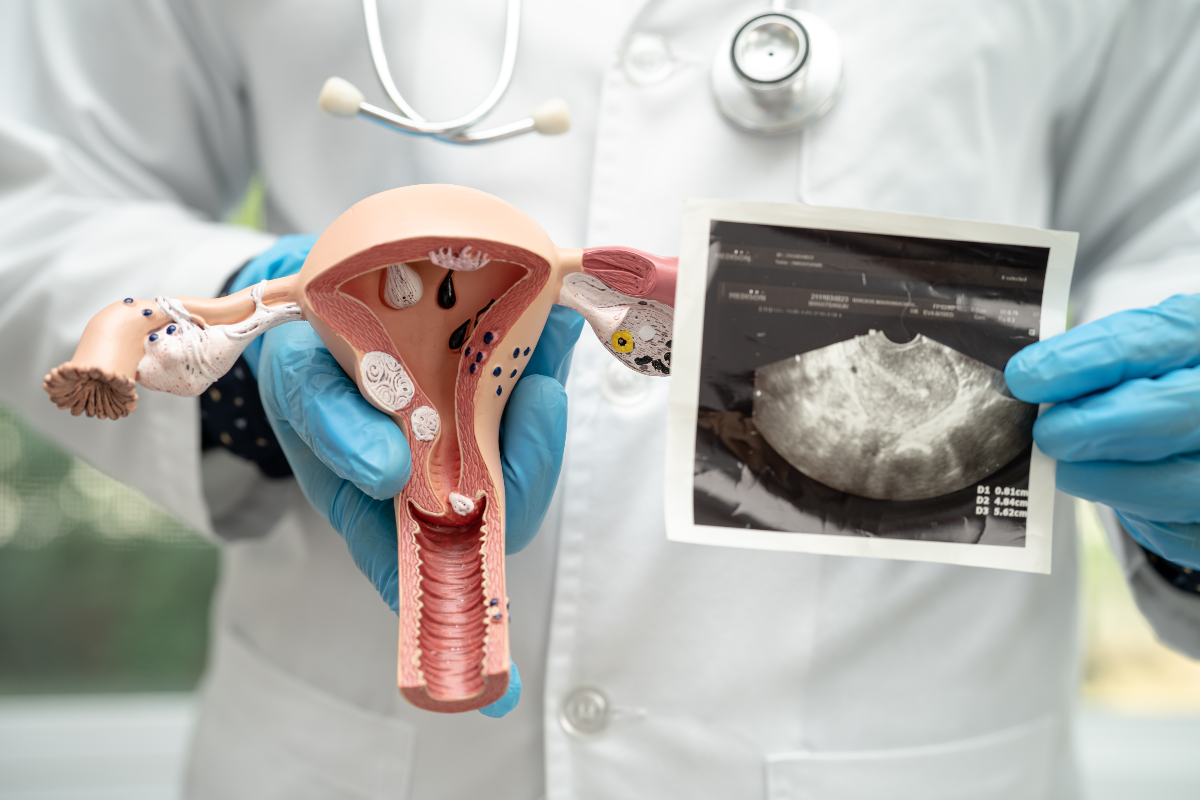 OvarianVax, Vacuna, cáncer de ovario, Salud, QuéOnnda
