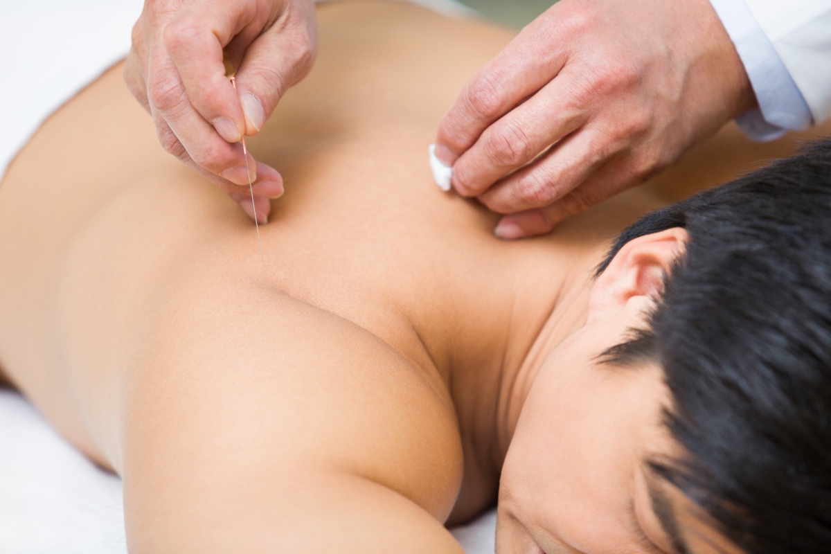 acupuntura, salud, ejercicio, disciplina