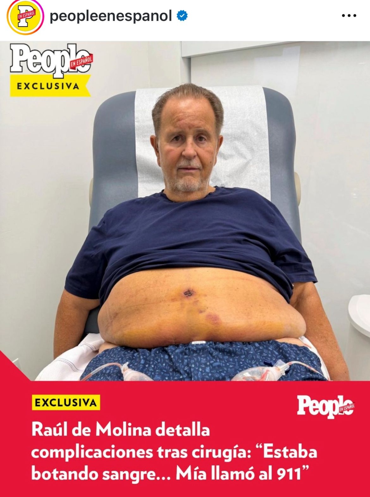 celebrities, surgery