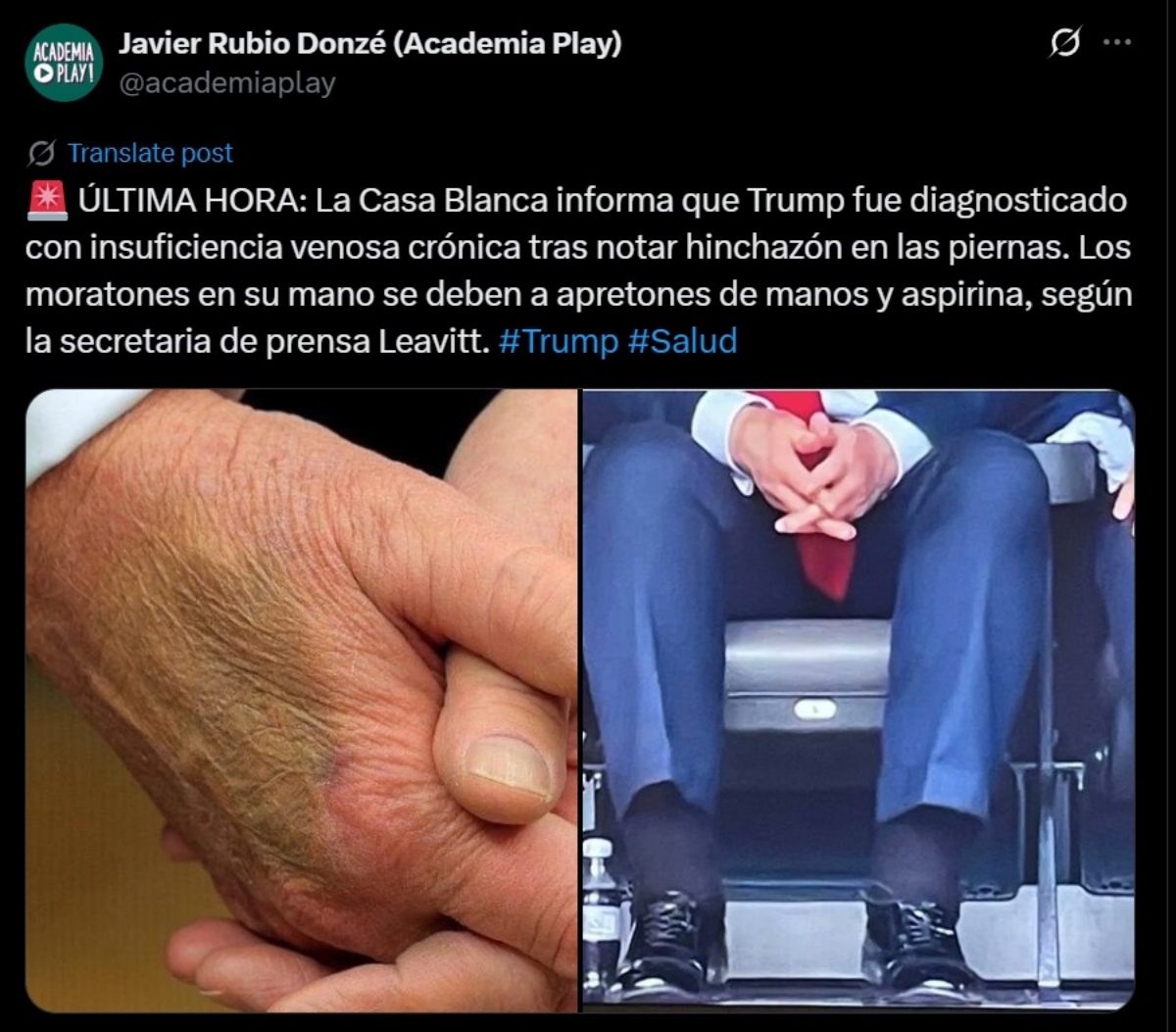 Donald Trump health