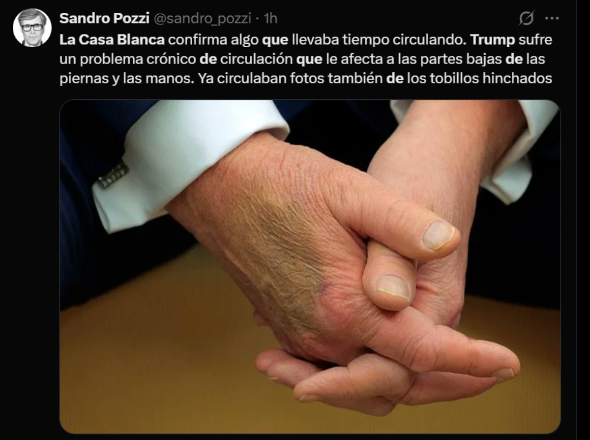 Donald Trump health