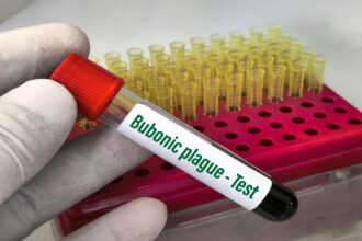 peste bubónica
