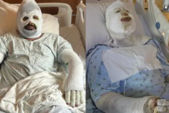 trabajadores hispanos Georgia quemaduras, Ronald Cruz y Kevin Díaz, Ronald Cruz, Kevin Díaz, QuéOnnda