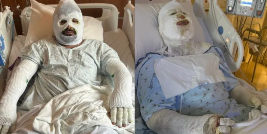 trabajadores hispanos Georgia quemaduras, Ronald Cruz y Kevin Díaz, Ronald Cruz, Kevin Díaz, QuéOnnda