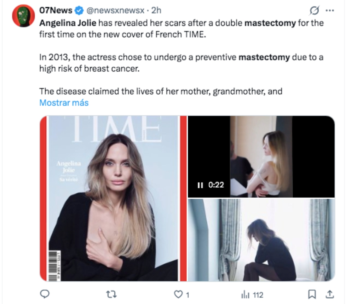 Angelina Jolie, mastectomía