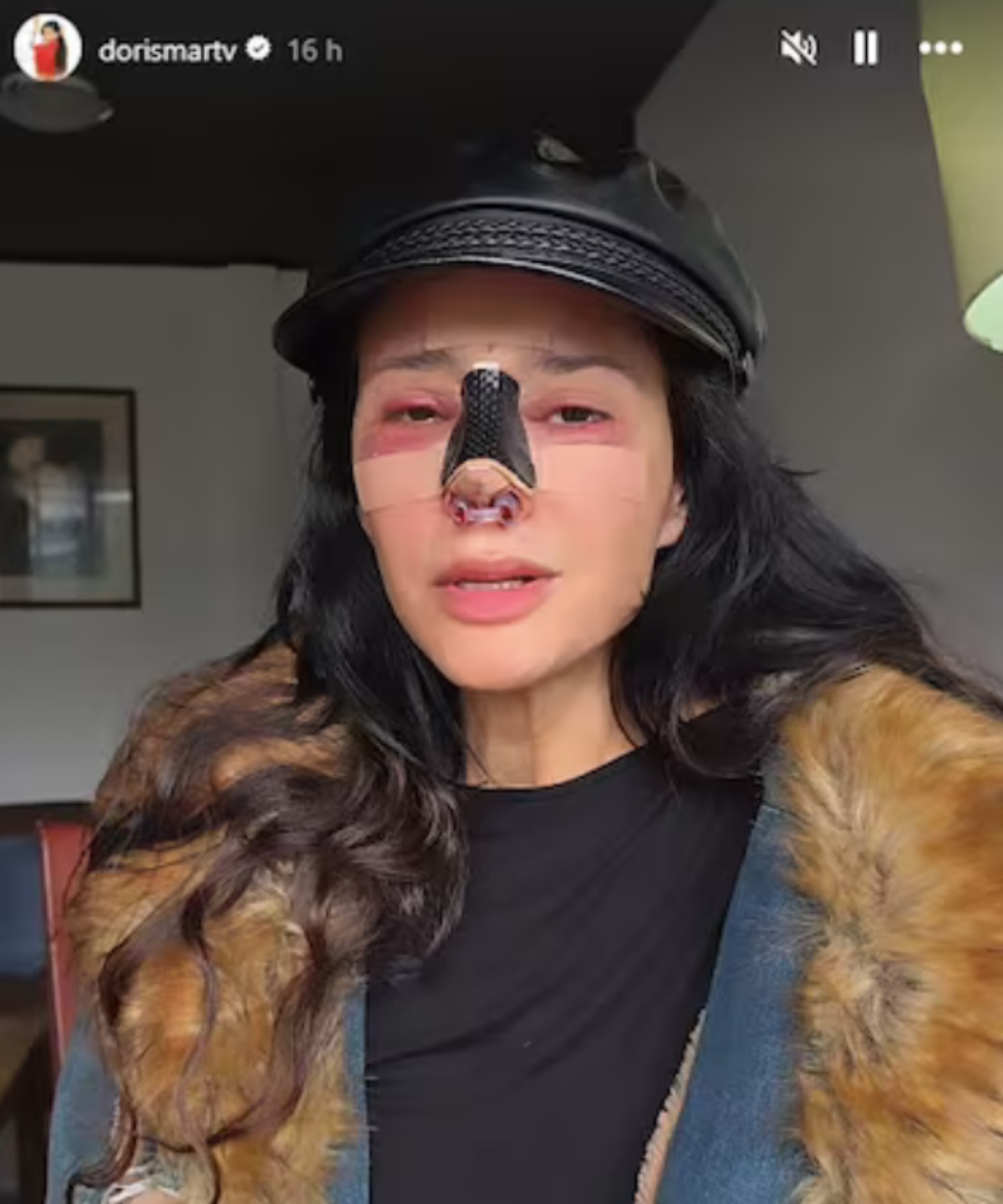 Dorismar, televisión