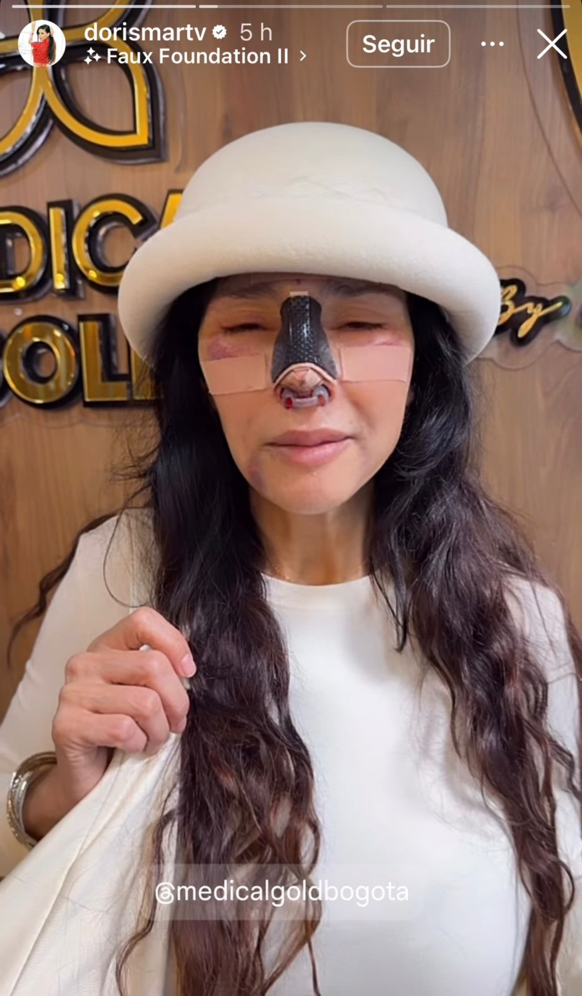 Dorismar, televisión