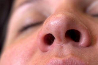 common cold, nasal passages, common cold, nasal passages, common cold, QuéOnnda