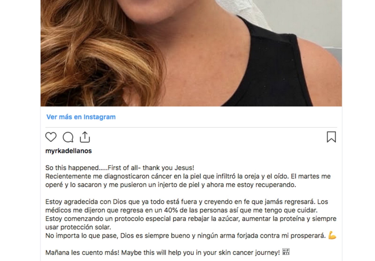 Myrka Dellanos tiene cáncer de piel
