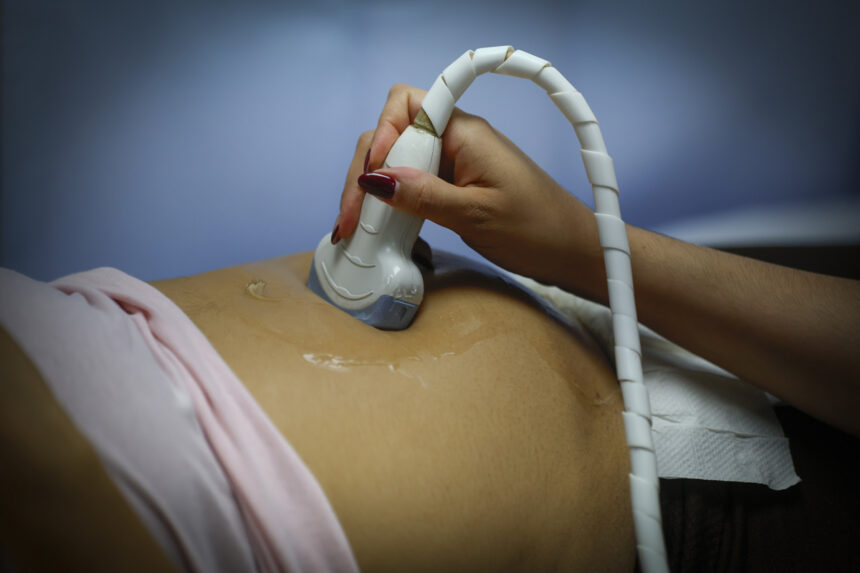 cause of preeclampsia, preeclampsia, pregnancy, placenta, QuéOnnda