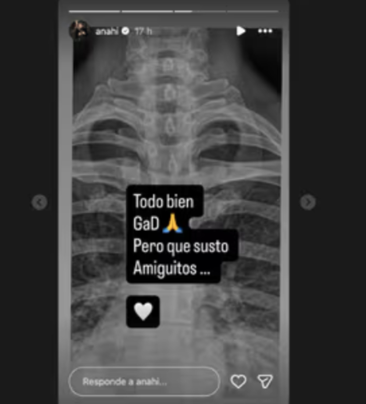 Anahi suffers severe accident and hurts her neck