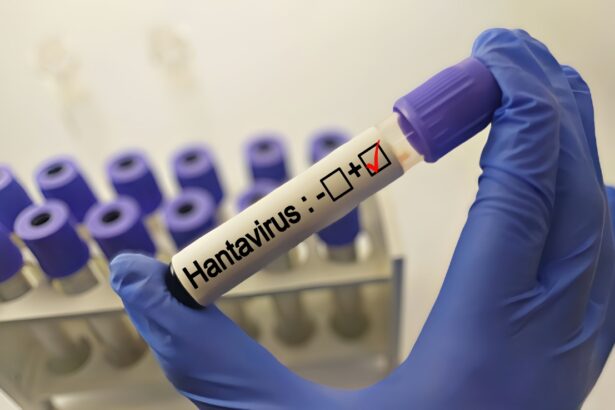 Hantavirus en Estados Unidos, Hantavirus, epidemia, Estados Unidos, QuéOnnda