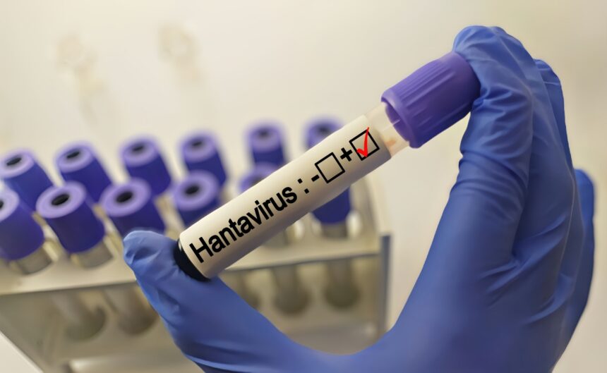 Hantavirus en Estados Unidos, Hantavirus, epidemia, Estados Unidos, QuéOnnda